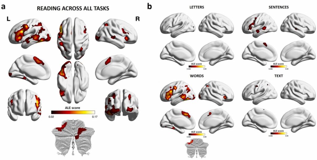 Le cerveau réagit différemment selon ce qu'on lit. // Source : Neuroscience & Biobehavioral Reviews Le cerveau réagit différemment selon ce qu'on lit. // Source : Neuroscience & Biobehavioral Reviews