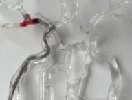 Le milli-spinner en train d'aspirer un caillot sanguin dans des tubes en plastiques // Source : Capture d'écran Nature vidéo - Ce petit appareil élimine les caillots sanguins Le milli-spinner en train d'aspirer un caillot sanguin dans des tubes en plastiques // Source : Capture d'écran Nature vidéo - Ce petit appareil élimine les caillots sanguins