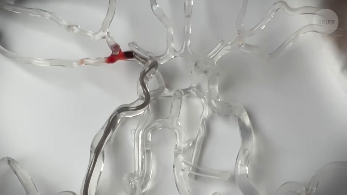 Le milli-spinner en train d'aspirer un caillot sanguin dans des tubes en plastiques // Source : Capture d'écran Nature vidéo - Ce petit appareil élimine les caillots sanguins Le milli-spinner en train d'aspirer un caillot sanguin dans des tubes en plastiques // Source : Capture d'écran Nature vidéo - Ce petit appareil élimine les caillots sanguins