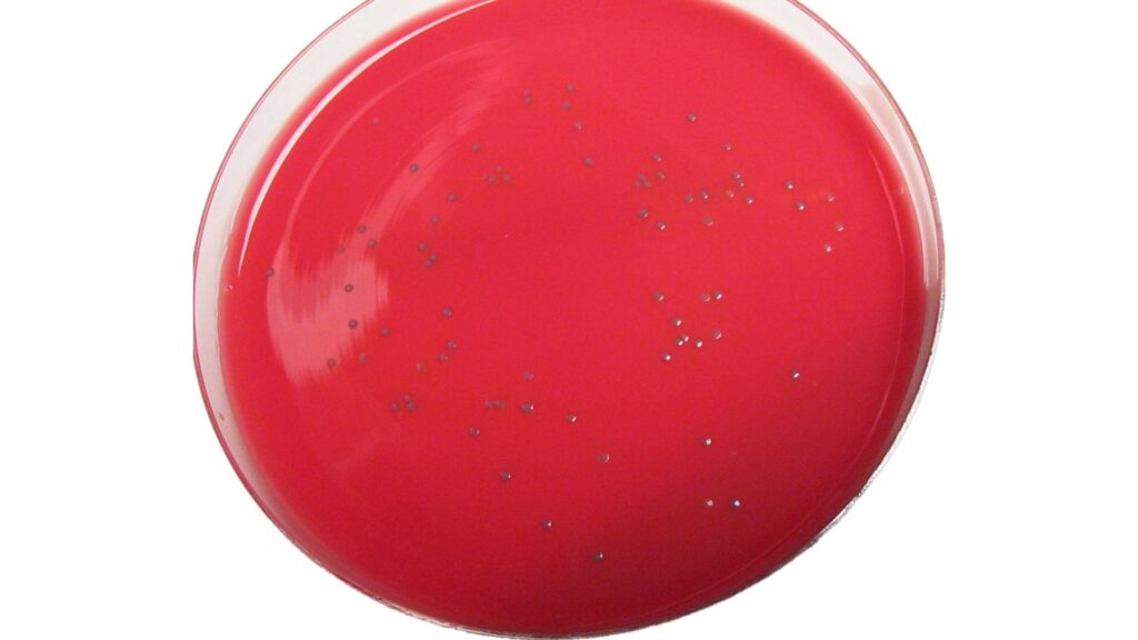Listeria monocytogenes dans une boite de Petri // Source : Wikimédia Listeria monocytogenes dans une boite de Petri // Source : Wikimédia