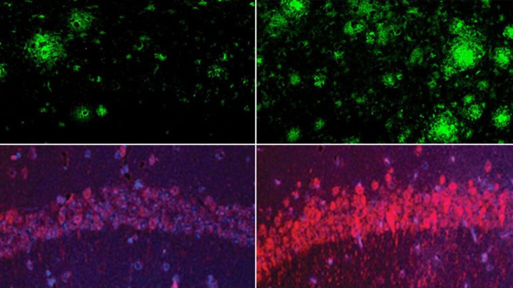 Modèle murin de la maladie d’Alzheimer. Rangée du haut : la carence en lithium (à droite) a augmenté considérablement les dépôts de bêta-amyloïde dans le cerveau, comparativement à des souris présentant des taux normaux de lithium (à gauche). Rangée du bas : Même chose pour la protéine tau, responsable de l’enchevêtrement des neurofibrille dans la maladie d’Alzheimer // Source : Yankner Lab Modèle murin de la maladie d’Alzheimer. Rangée du haut : la carence en lithium (à droite) a augmenté considérablement les dépôts de bêta-amyloïde dans le cerveau, comparativement à des souris présentant des taux normaux de lithium (à gauche). Rangée du bas : Même chose pour la protéine tau, responsable de l’enchevêtrement des neurofibrille dans la maladie d’Alzheimer // Source : Yankner Lab