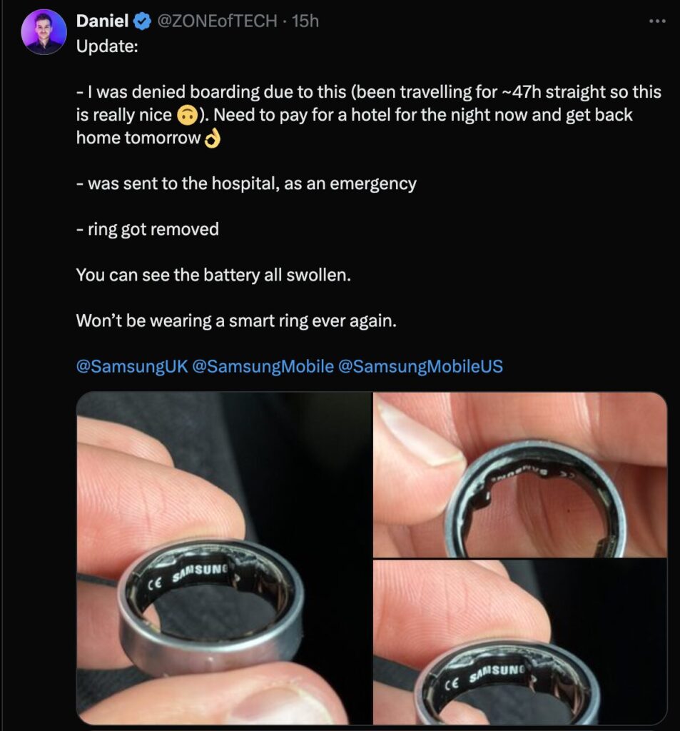 La batterie de la bague s'est complètement déformée.