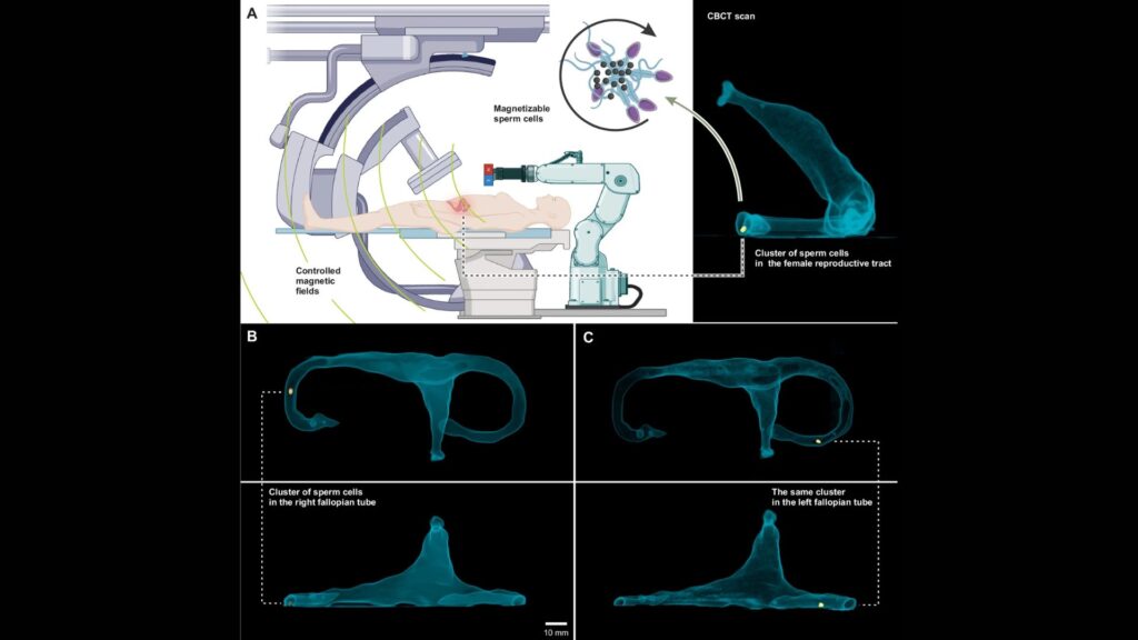 Microrobots biohybrides à base de sperme ciblant un traitement peu invasif dans l'appareil reproducteur féminin avec des champs magnétiques externes faibles, à basse fréquence et contrôlés et l'imagerie par fluoroscopie aux rayons X pour la localisation des grappes de spermatozoïdes magnétisables. // Source : npj Robotics (npj Robot)- ISSN 2731-4278 (online)