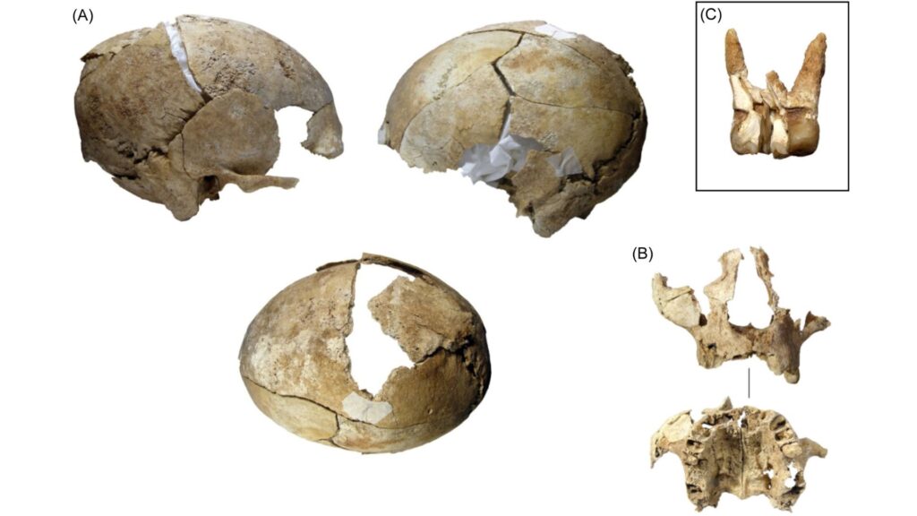 (A) Vues du crâne humain une fois reconstitué ; (B) Partie du visage du même individu ; (C) Détail d'une dent avec une cavité // Source : Silvia Carnicero (A) Vues du crâne humain une fois reconstitué ; (B) Partie du visage du même individu ; (C) Détail d'une dent avec une cavité // Source : Silvia Carnicero