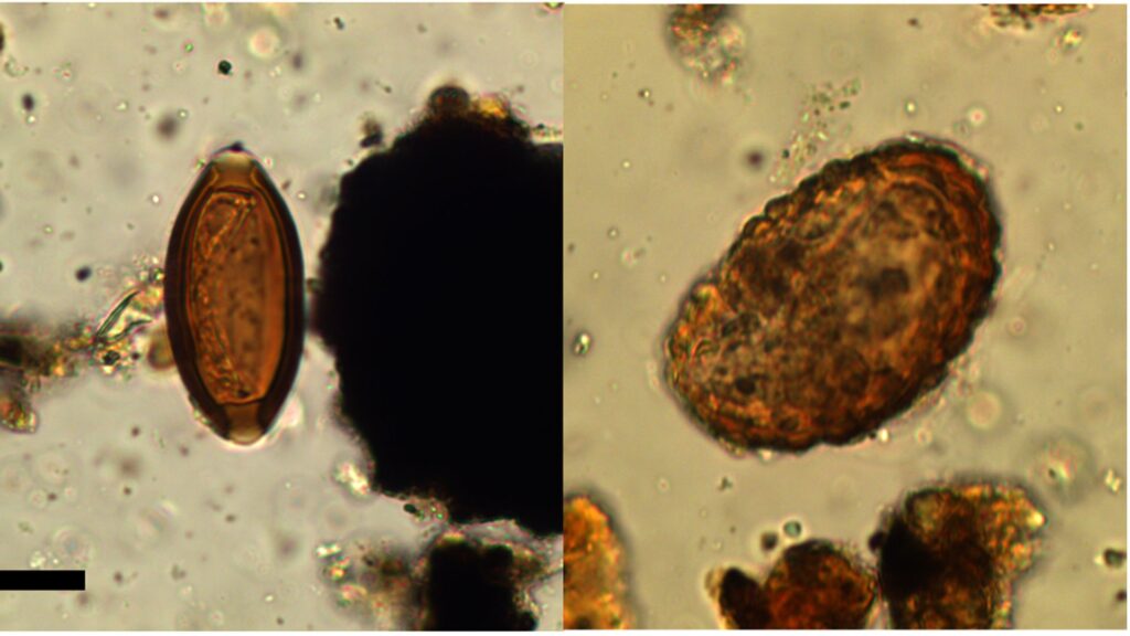 œufs de Trichuris sp. (gauche), Ascaris sp (droite). Deux des parasites retrouvés, vus au microscope