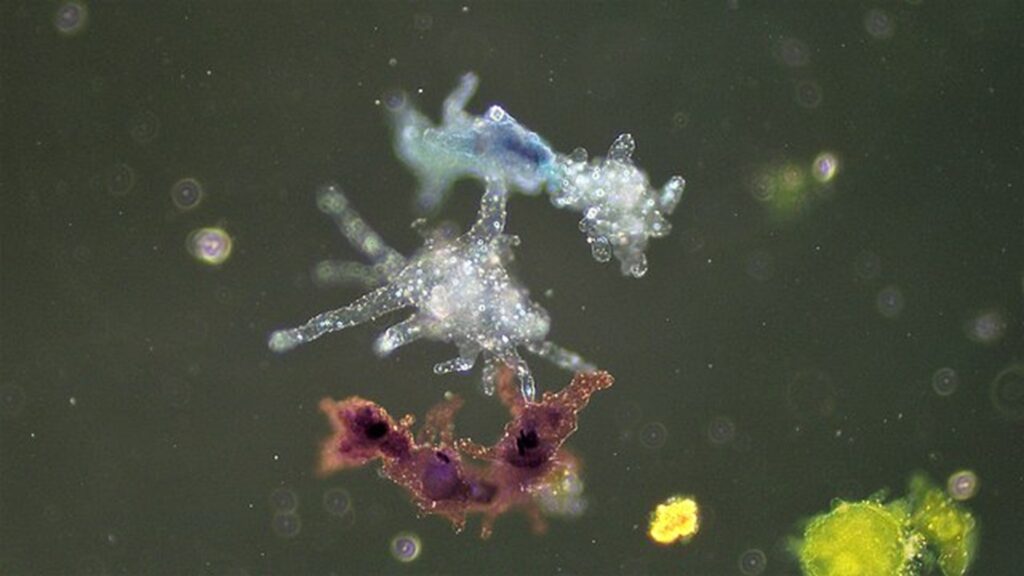 640px-Ameboid_Protozoa_Amoeba_proteus_(37175354480)