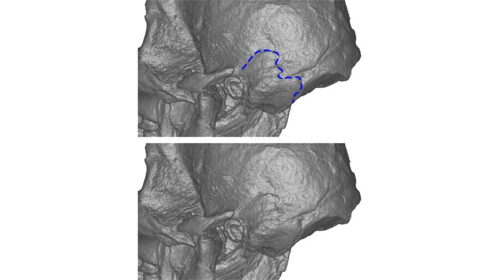 StW 573 (Little Foot) en vue latérale. La ligne bleue soulignant la présence d'une encoche astérionique qui diffère du spécimen de type d'A. prometheus (MLD 1) // Source : American Journal of Biological Anthropology StW 573 (Little Foot) en vue latérale. La ligne bleue soulignant la présence d'une encoche astérionique qui diffère du spécimen de type d'A. prometheus (MLD 1) // Source : American Journal of Biological Anthropology