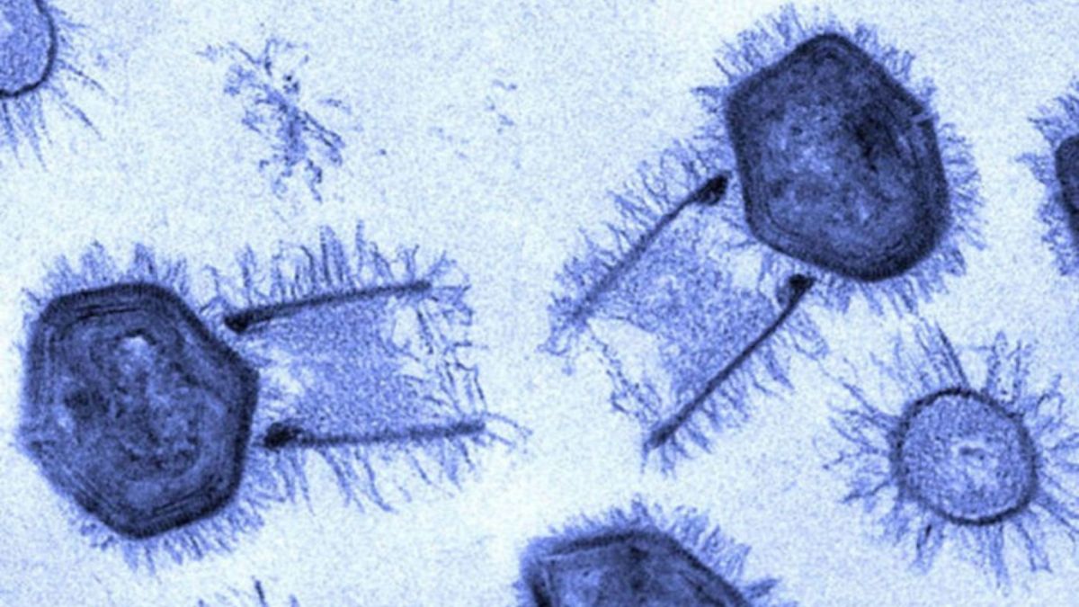 Des Tupanvirus, virus géants à ADN. // Source : Wkimédia : Jônatas Abrahão Des Tupanvirus, virus géants à ADN. // Source : Wkimédia : Jônatas Abrahão