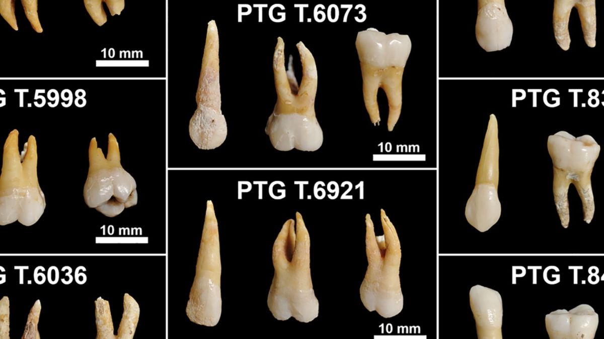 Échantillon dentaire analysé. // Source : PLOS (image recadrée) Échantillon dentaire analysé. // Source : PLOS (image recadrée)