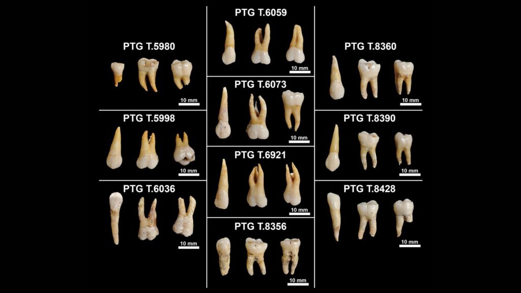 Échantillon dentaire analysé. // Source : PLOS (image recadrée) Échantillon dentaire analysé. // Source : PLOS (image recadrée)