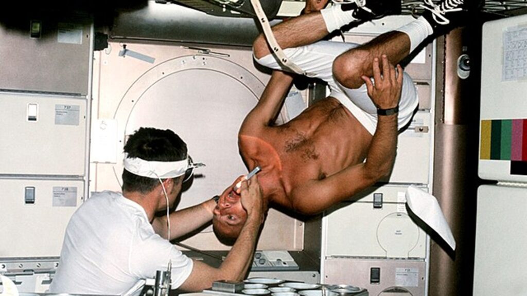 Pete Conrad en plein examen dentaire à bord du Skylab en 1973. Pete Conrad en plein examen dentaire à bord du Skylab en 1973.