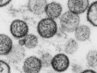 Hantavirus. // Source : Institut Pasteur