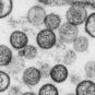 Hantavirus. // Source : Institut Pasteur Hantavirus. // Source : Institut Pasteur