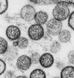 Hantavirus. // Source : Institut Pasteur