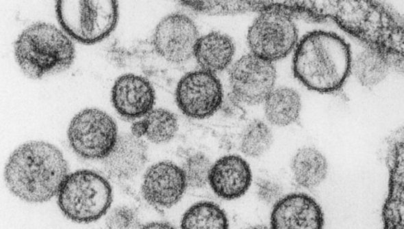 Hantavirus. // Source : Institut Pasteur Hantavirus. // Source : Institut Pasteur