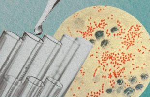 Yersinia pestis, l'agent infectieux de la peste. // Source : Wikimedia/CDC ; montage Numerama avec Canva