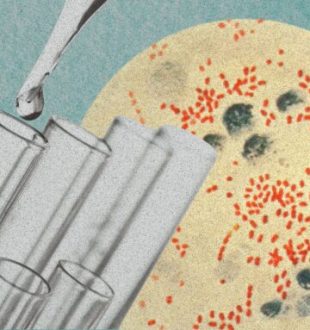 Yersinia pestis, l'agent infectieux de la peste. // Source : Wikimedia/CDC ; montage Numerama avec Canva