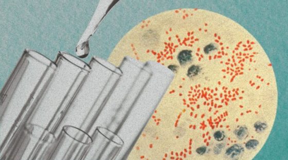Yersinia pestis, l'agent infectieux de la peste. // Source : Wikimedia/CDC ; montage Numerama avec Canva Yersinia pestis, l'agent infectieux de la peste. // Source : Wikimedia/CDC ; montage Numerama avec Canva
