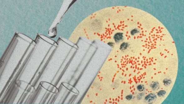 Yersinia pestis, l'agent infectieux de la peste. // Source : Wikimedia/CDC ; montage Numerama avec Canva Yersinia pestis, l'agent infectieux de la peste. // Source : Wikimedia/CDC ; montage Numerama avec Canva