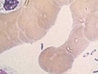 Bactérie Yersinia pestis. // Source : Wikimedia/CDC Bactérie Yersinia pestis. // Source : Wikimedia/CDC