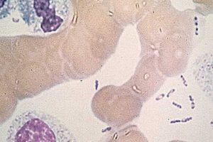 Bactérie Yersinia pestis. // Source : Wikimedia/CDC Bactérie Yersinia pestis. // Source : Wikimedia/CDC