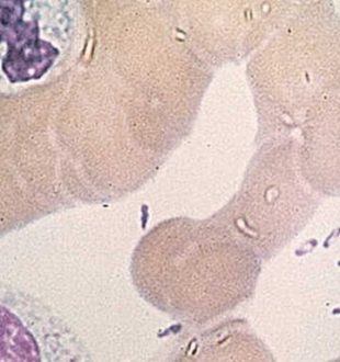 Bactérie Yersinia pestis. // Source : Wikimedia/CDC Bactérie Yersinia pestis. // Source : Wikimedia/CDC