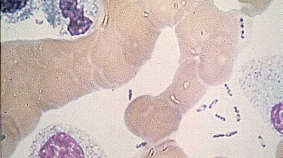 Bactérie Yersinia pestis. // Source : Wikimedia/CDC Bactérie Yersinia pestis. // Source : Wikimedia/CDC