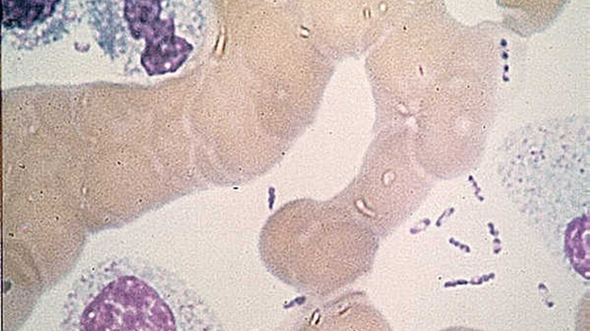 Bactérie Yersinia pestis. // Source : Wikimedia/CDC Bactérie Yersinia pestis. // Source : Wikimedia/CDC