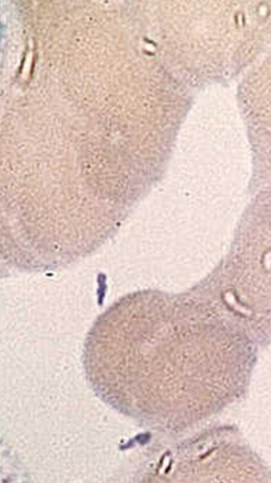 Bactérie Yersinia pestis. // Source : Wikimedia/CDC Bactérie Yersinia pestis. // Source : Wikimedia/CDC